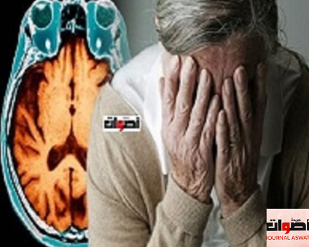 مرض الزهايمر Alzheimer والدماغ