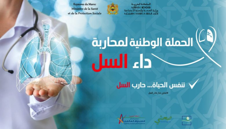 وزارة الصحة و الحماية الإجتماعية تطلق حملة وطنية للوقاية من داء السل