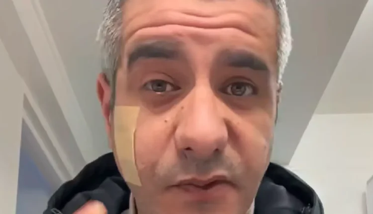 فرنسا تعتقل تيكتوكر جزائري لقيامه بالتحريض على العنف ضد معارضين للنظام