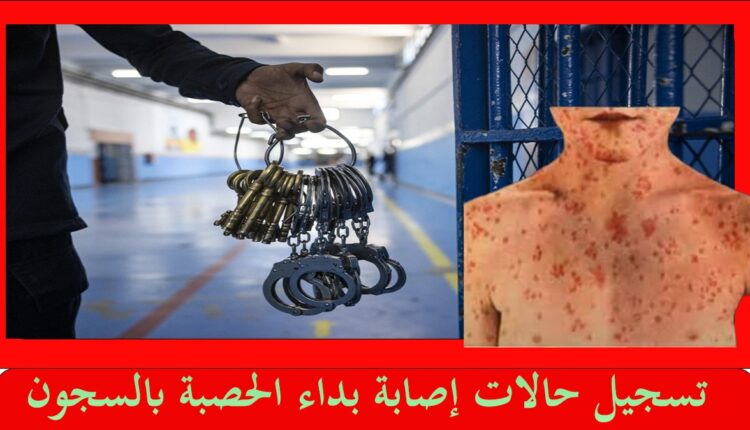 أعلنت المندوبية العامة لإدارة السجون وإعادة الإدماج في المغرب، في بيان رسمي صدر اليوم الأربعاء 8 يناير، عن تسجيل 41 إصابة بداء الحصبة المعروف باسم "بوحمرون" بين نزلاء المؤسسات السجنية في مختلف مناطق البلاد