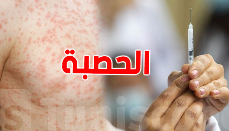 بعد تفشي داء الحصبة في جرادة.. حملات توعوية حول أهمية التلقيح