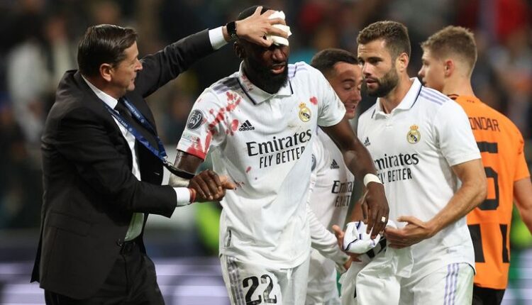 روديغر يتعرض لإصابة تهدد مشاركته في ديربي مدريد
