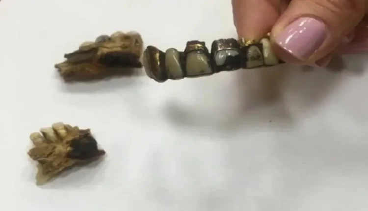 نشر صورة لفك هتلر المحفوظ في أرشيف جهاز الأمن الفدرالي الروسي