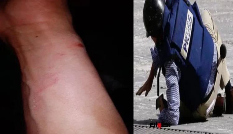 اعتداء سافر على صحفي جريدة "أصوات" يكشف عن شبكة فساد وتواطؤ