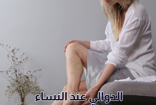 دوالي الساقين.. النساء أكثر عرضة وهذه علامات الخطر